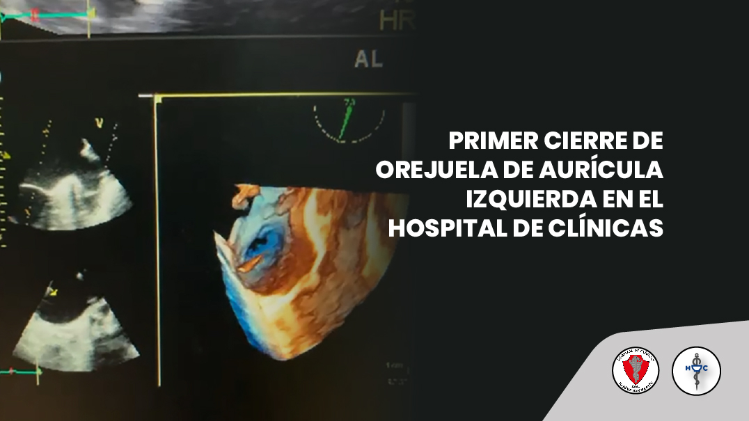 CIERRE DE OREJUELA DE AURICULA IZQUIERDA 